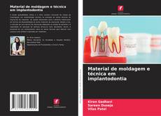 Bookcover of Material de moldagem e técnica em implantodontia