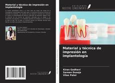 Bookcover of Material y técnica de impresión en implantología