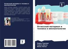 Buchcover von Оттискной материал и техника в имплантологии