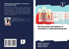 Couverture de Оттискной материал и техника в имплантологии