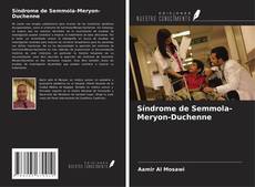 Buchcover von Síndrome de Semmola-Meryon-Duchenne