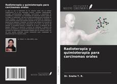 Buchcover von Radioterapia y quimioterapia para carcinomas orales