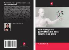 Bookcover of Radioterapia e quimioterapia para carcinomas orais