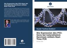 Die Expression des P53-Gens bei kolorektalem Karzinom mittels Real-Time PCR kitap kapağı