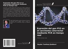 Buchcover von Expresión del gen P53 en el carcinoma colorrectal mediante PCR en tiempo real