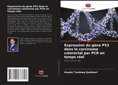 Couverture de Expression du gène P53 dans le carcinome colorectal par PCR en temps réel
