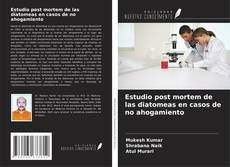 Bookcover of Estudio post mortem de las diatomeas en casos de no ahogamiento