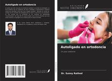 Bookcover of Autoligado en ortodoncia