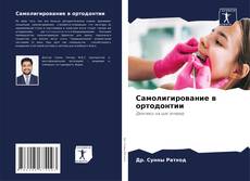 Buchcover von Самолигирование в ортодонтии