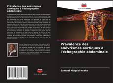 Copertina di Prévalence des anévrismes aortiques à l'échographie abdominale