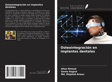 Buchcover von Osteointegración en implantes dentales