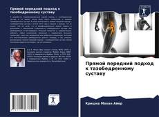 Bookcover of Прямой передний подход к тазобедренному суставу