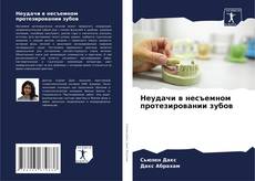 Buchcover von Неудачи в несъемном протезировании зубов