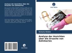 Bookcover of Analyse der Ansichten über die Ursache von Zahnkaries