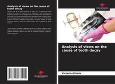 Portada del libro de Analysis of views on the cause of tooth decay
