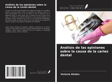 Buchcover von Análisis de las opiniones sobre la causa de la caries dental