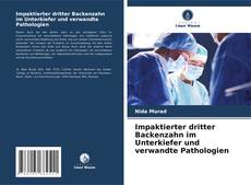 Impaktierter dritter Backenzahn im Unterkiefer und verwandte Pathologien kitap kapağı