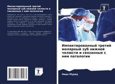 Couverture de Импактированный третий молярный зуб нижней челюсти и связанные с ним патологии