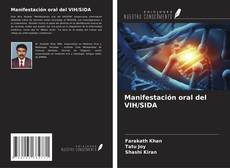 Bookcover of Manifestación oral del VIH/SIDA