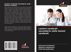 Capa do livro de Lesioni cerebrali secondarie nelle lesioni cerebrali 