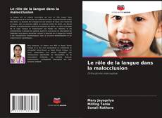 Bookcover of Le rôle de la langue dans la malocclusion