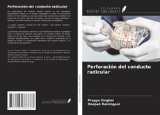 Bookcover of Perforación del conducto radicular