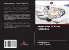 Обложка Perforation du canal radiculaire