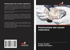 Buchcover von Perforazione del canale radicolare