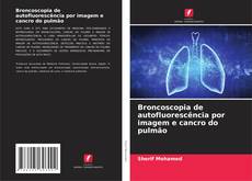 Copertina di Broncoscopia de autofluorescência por imagem e cancro do pulmão