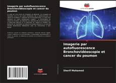 Bookcover of Imagerie par autofluorescence Bronchovidéoscopie et cancer du poumon
