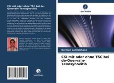 CSI mit oder ohne TSC bei de-Quervain-Tenosynovitis kitap kapağı