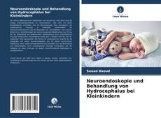 Neuroendoskopie und Behandlung von Hydrocephalus bei Kleinkindern kitap kapağı
