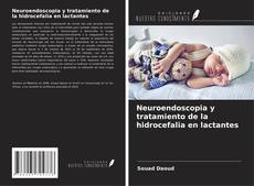 Buchcover von Neuroendoscopia y tratamiento de la hidrocefalia en lactantes