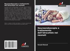 Copertina di Neuroendoscopia e trattamento dell'idrocefalo nei neonati