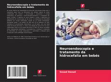 Neuroendoscopia e tratamento da hidrocefalia em bebés kitap kapağı