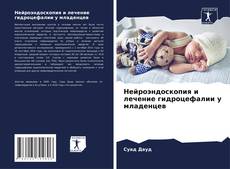Нейроэндоскопия и лечение гидроцефалии у младенцев kitap kapağı