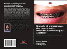 Buchcover von Biologie et biomarqueurs des mouvements dentaires orthodontiques accélérés