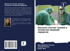 Buchcover von Лоскуты мягких тканей в челюстно-лицевой хирургии