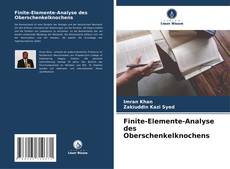 Обложка Finite-Elemente-Analyse des Oberschenkelknochens
