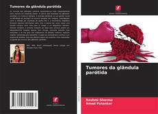 Bookcover of Tumores da glândula parótida