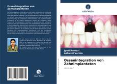 Capa do livro de Osseointegration von Zahnimplantaten 