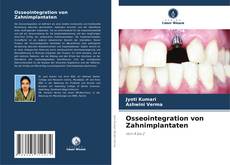 Osseointegration von Zahnimplantaten kitap kapağı