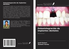 Buchcover von Osteointegración de implantes dentales