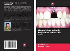 Bookcover of Osseointegração de Implantes Dentários