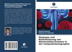 Portada del libro de Diagnose und Klassifizierung von Nierenzellkarzinomen in der Computertomographie
