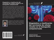 Borítókép a  Diagnóstico y clasificación del carcinoma de células renales en la tomografía computarizada - hoz