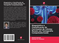 Bookcover of Diagnóstico e Classificação do Carcinoma de Células Renais em Tomografia Computadorizada