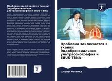 Buchcover von Проблема заключается в тканях: Эндобронхиальная ультрасонография и EBUS-TBNA