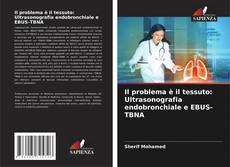 Bookcover of Il problema è il tessuto: Ultrasonografia endobronchiale e EBUS-TBNA