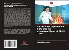 Buchcover von Le tissu est le problème : Échographie endobronchique et EBUS-TBNA